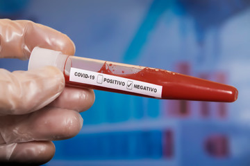 Fototapeta premium Tubo de muestra con sangre negativa con COVID-19 o nuevo coronavirus