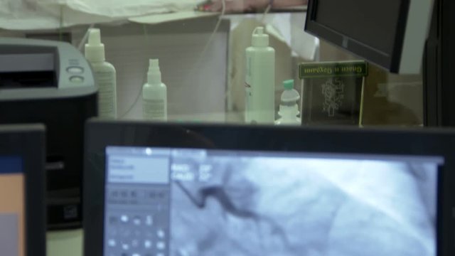 human on medical research in clinic, angiography and surgical operation