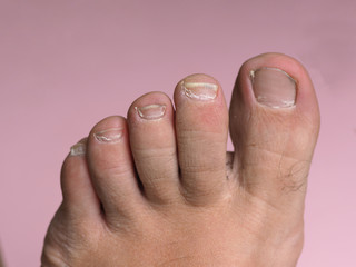long nails on a male foot without a pedicure on a pink background © Олексій Остистий