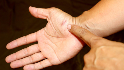 Arm is wound from a knife.