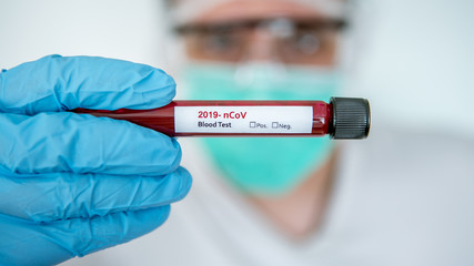 Man with test tube of infected blood sample for COVID-19. Coronavirus