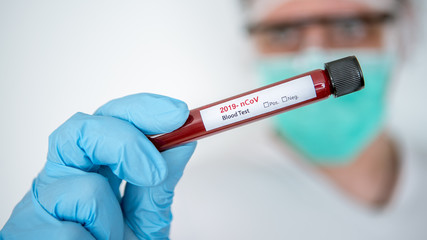 Obraz premium Scientist with coronavirus Covid 19 infected blood sample tube. Pandemic concept