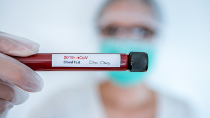 Asian woman COVID-19 laboratory test sample of blood new Corona virus infection