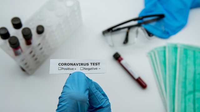 Scientist with identifier sticker test tube with infected blood sample COVID-19