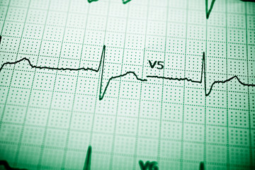 Electrocardiograph close up