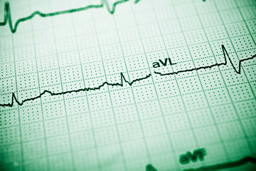 Electrocardiograph close up