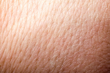 Human skin