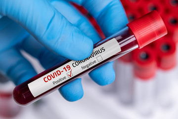 Obraz premium Coronavirus Blood Sample