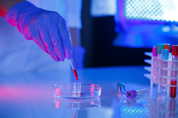 A medical professional, laboratory assistant, doctor performs an analysis in a laboratory, uses test tubes, a pipette and a petri dish for the presence of bacteria in the human body