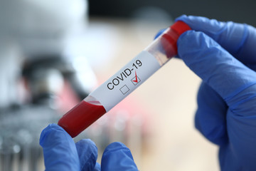 Male chemist hand in blue protective gloves hold test tube closeup background