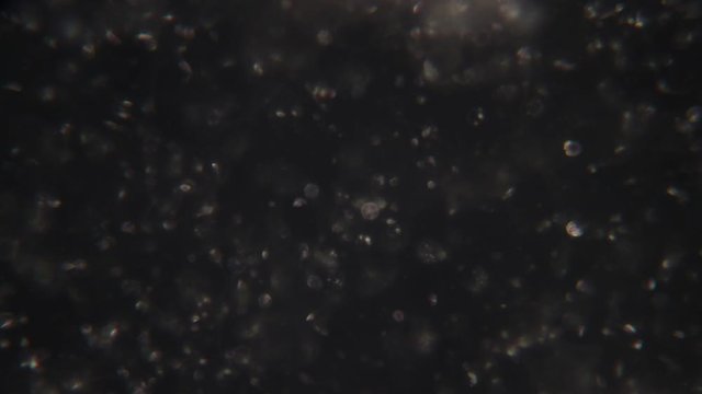 Semen, seminal fluid of Human under the microscope.