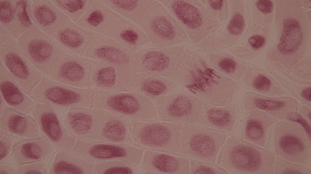 Root tip of Onion and Mitosis cell in the Root tip of Onion under a microscope.