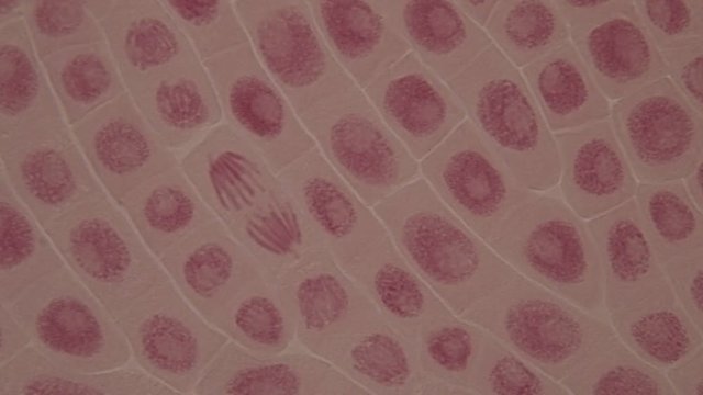 Root tip of Onion and Mitosis cell in the Root tip of Onion under a microscope.