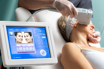 Middle aged woman receiving high intensity focused ultrasound treatment on face.
