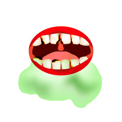 caries. Smell from the mouth. Halitosis. The structure of the teeth and oral cavity. Diseases of the teeth caries. Infographics. Vector illustration on isolated background.