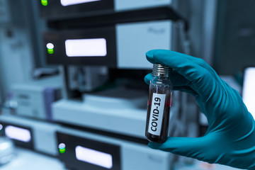 Scientist holding Test tube with blood sample for COVID-19 test,Experiment to detect virus was found in the blood.