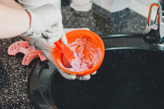 Alginate impression, orthodontist prepares a pink mixture to measure the patient's mouth