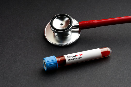 CORONAVIRUS text with stethoscope and blood sample vacuum tube on black background. Covid or Coronavirus Concept