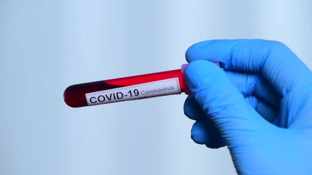 Doctor testing  samples for coronavirus covid - 19 novel corona virus