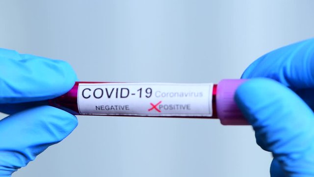 Coronavirus covid 19 test kit corona virus