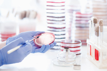 Microbiology laboratory agar plate full of micro bacterias and microorganisms E. coli grow...