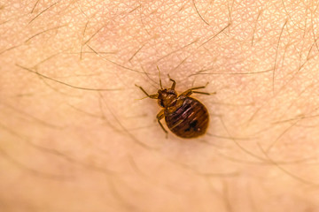 Bed Bug On Skin 