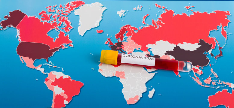 World map of Coronavirus and blood sample. Countries with Covid-19, Covid 19 map confirmed cases report worldwide globally. Border control and quarantine of tourists infected with coronavirus.
