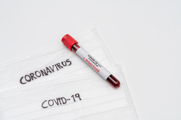 COVID 19 Coronavirus, infected blood sample in the sample tube