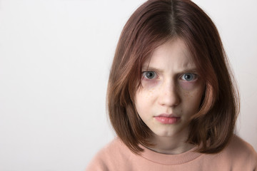 face of displeased angry indignant upset teenager girl with freckles