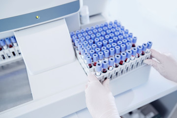 Blood test tube laboratory for analysis with virus epidemic
