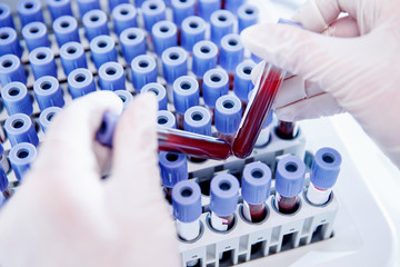 Lab worker preparing test blood for detection of antibodies and infections Corona virus