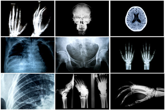 Collage of many X-rays. Very good quality , Many others X-ray 