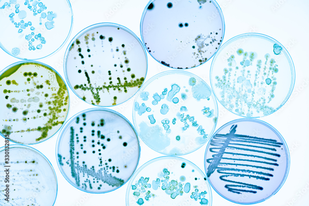 Poster mixed of bacteria colonies and fungus in various petri dish