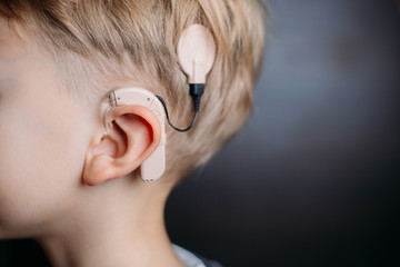 cochlear implant on the boy’s head. hearing aid. copy space - obrazy, fototapety, plakaty