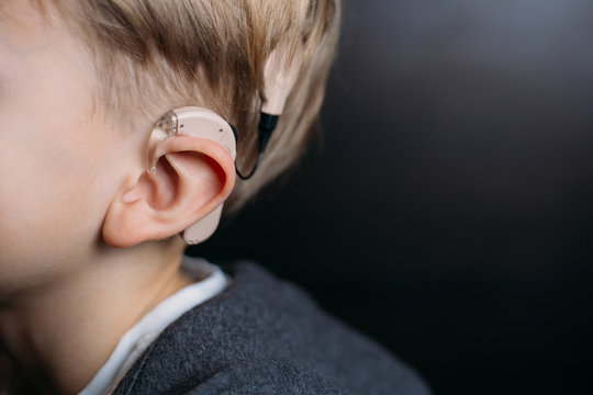 cochlear implant on the boy’s head. hearing aid. copy space