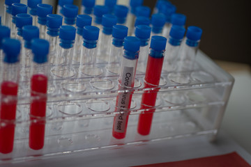 Test Tube Rack with Test Coronavirus Tubes, close up view.  Pandemic concept.