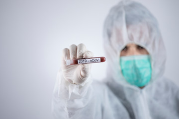 provetta con sangue per test su coronavirus, tenuta in mano da un medico