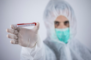 provetta con sangue per test su coronavirus, tenuta in mano da un medico