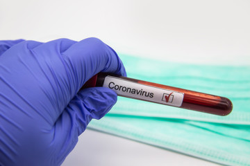 Obraz premium Coronavirus blood test 2019.Coronavirus came from Wuhan, China. Doctor hand in medical glove holding test tube with Coronavirus positive blood in laboratory. Concept can be used in the design
