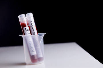 Provettaa per il controllo del sangue su coronavir- sfondo nero