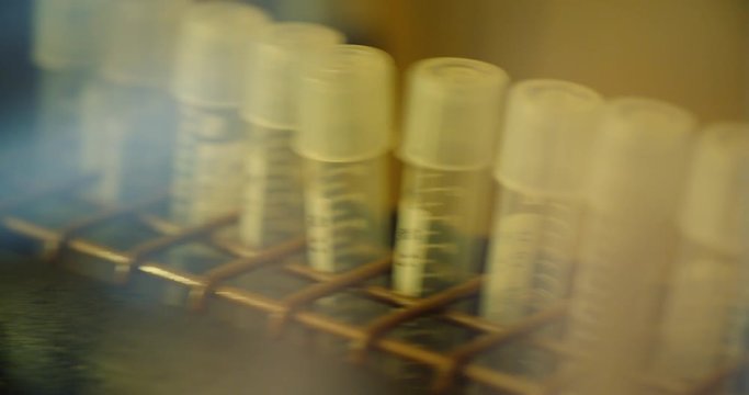 test tubes with bacteria in shaker at laboratory