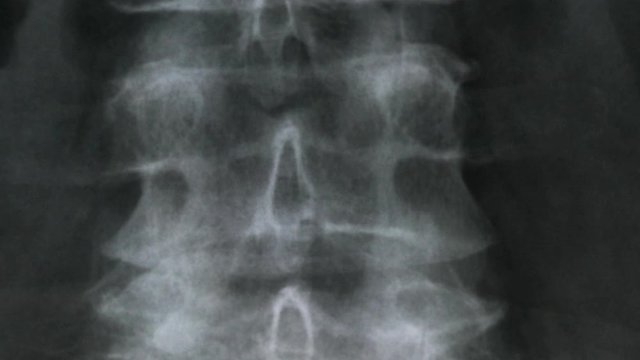 X-ray of the bones of the human vertebral column and pelvis, 4K