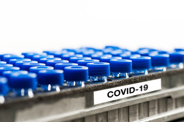 Mini glass test tubes with Coronavirus samples