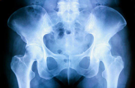 X-ray of pelvic bones anatomy