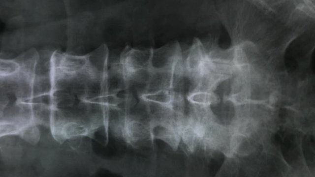 X-ray of the bones of the human vertebral column and pelvis, 4K