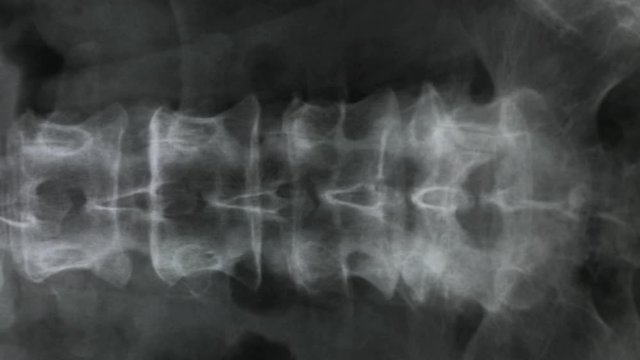 X-ray of the bones of the human vertebral column and pelvis, 4K