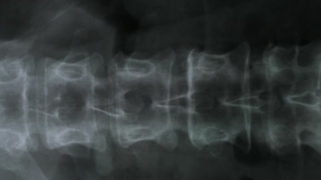X-ray of the bones of the human vertebral column and pelvis, 4K