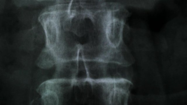 X-ray of the bones of the human vertebral column and pelvis, 4K