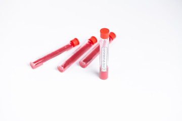 negative and positive test for coronavirus in laboratory with test tubes