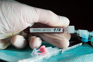 Professional doctor or lab technician holding blood sample with novel (new) coronavirus N.C.P....